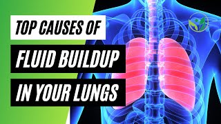 Causes of Fluid Buildup In Your Lungs: Pulmonary Edema Causes & Symptoms