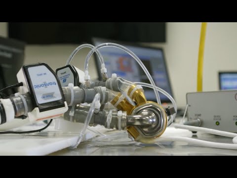 Revolutionary BiVACOR heart device moves to phase 2 of FDA trial