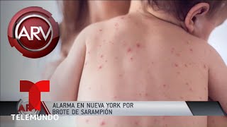 Lo nuevo por emergencia sanitaria por brote de sarampión | Al Rojo Vivo