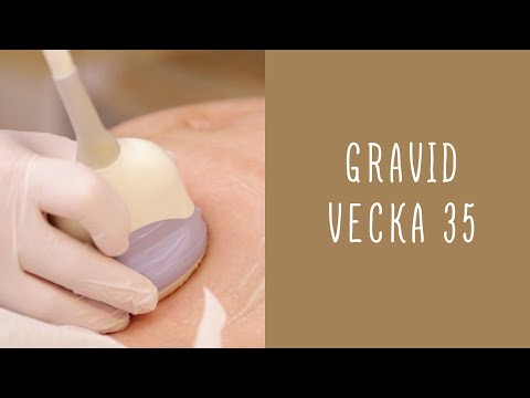 Gravid vecka 35