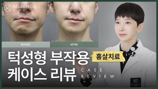 [ENG] 턱 절골 수술 흉살 치료, 경과는 정밀 초음파 진단으로!
