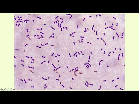 Alpha-Hemolytic Streptococci - Microbiology Boot Camp