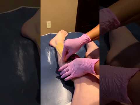 Leg sugaring hair removal