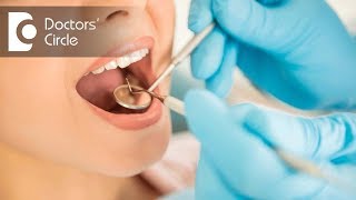 What dentists do when one go for root planing & scaling teeth? - Dr. Shamaz Mohamed
