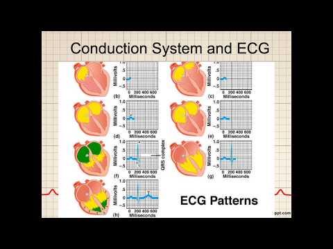 ECG Basics