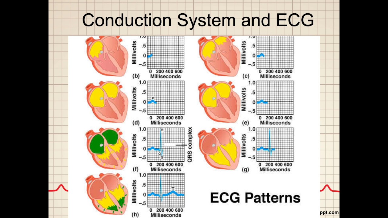 ECG Basics