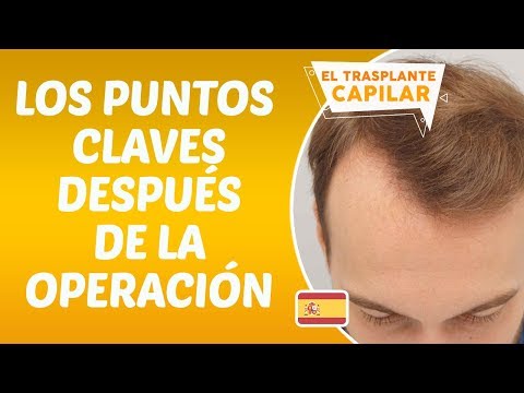 Sobre las preguntas después del trasplante de capilar - Dr. Hamid AYDIN