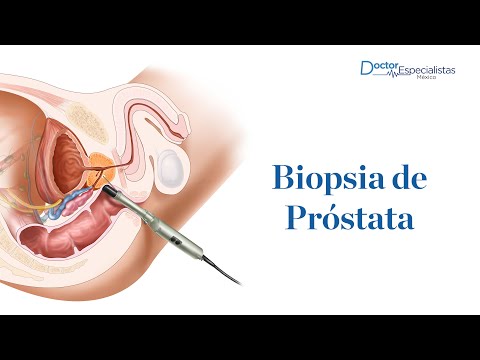 Tumore prostata: sintomi