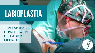 Cirugía de Labioplastia o Ninfoplastia - Dra. Patricia Gutiérrez Ontalvilla - Cirujana Plástica