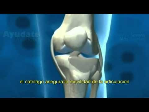 Colágeno Fortigel Forticoll 300 g