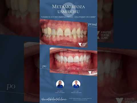 Marcin Lenkowski-6
