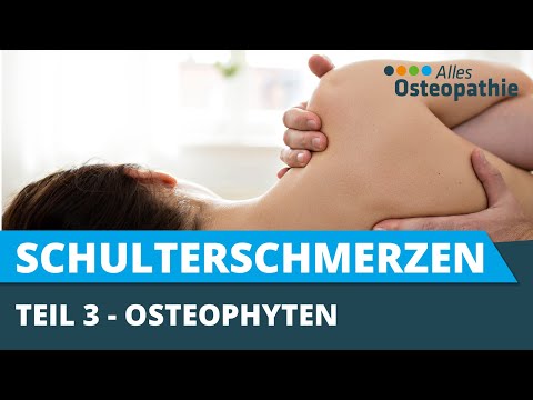 Schulterschmerzen aus osteopathischer Sicht - Osteophyten