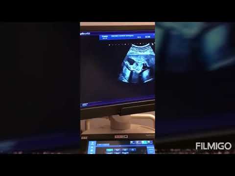 Happy birthday Sriraksha  // Chinanchiru killiye