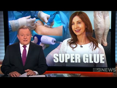 VenaSeal Vein Glue Treatment at Vein Health Medical Clinic, Melbourne and Sydney