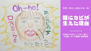 [世界一周]顔にカビが生えた理由