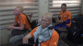Albi Week 7e édition : les personnes atteintes d'albinisme plaident pour une véritable inclusion