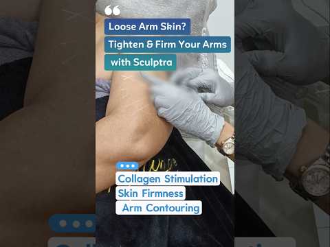 Tighten & Firm Loose Arm Skin with Sculptra | Body Collagen Stimulation