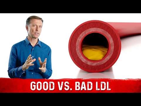 You Have Good and Bad LDL (low-density lipoprotein)