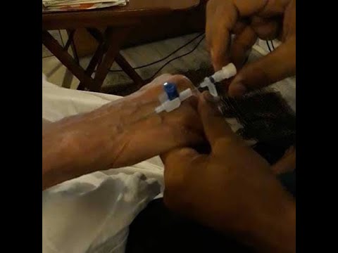 Critical extravasation: Risk Factors & Prevention Strategies