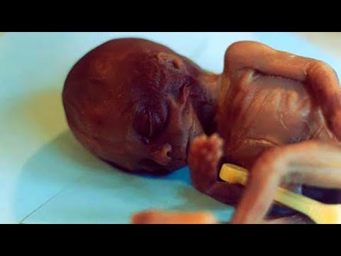 Quick Facts About Abortion