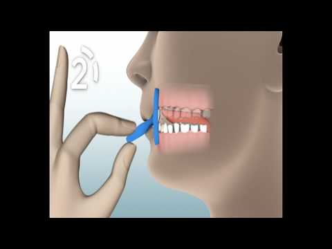 FaceFormer - Zugübung 3