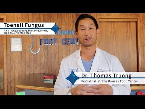 How to Get Rid of Toenail Fungus Effectively