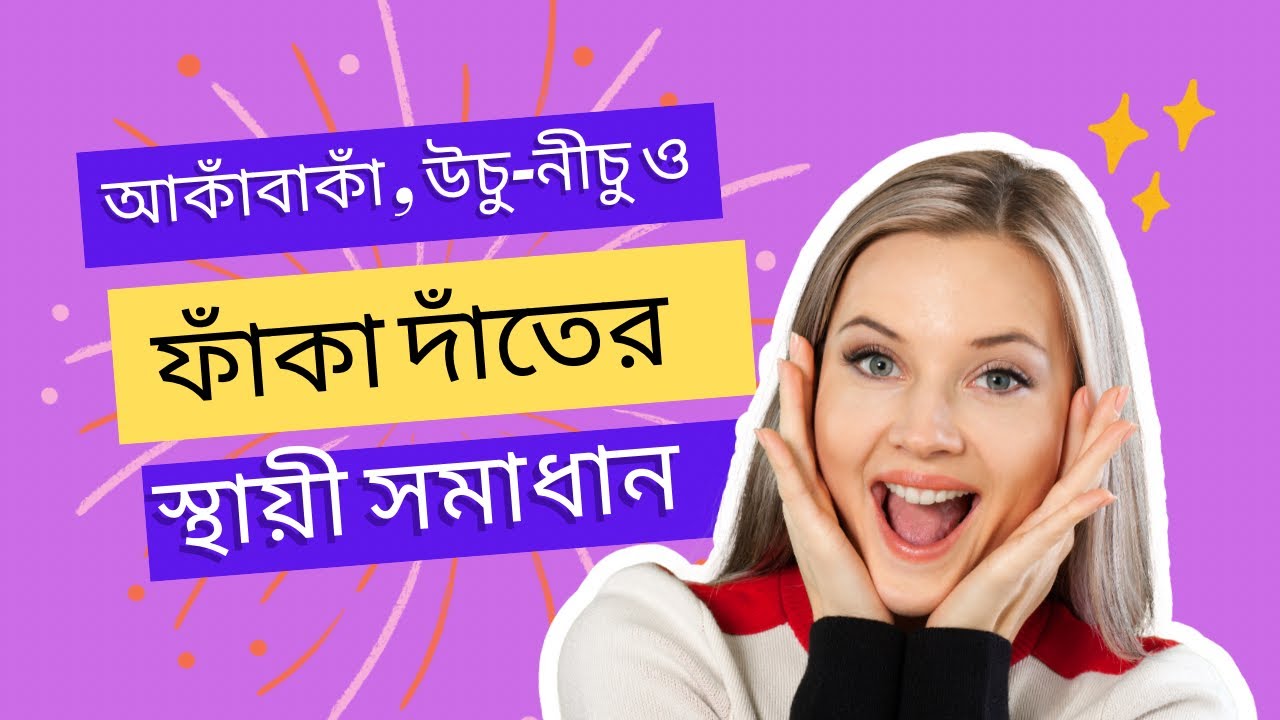 আঁকাবাকা উঁচু নীচু ও ফাঁকা দাঁতের স্থায়ী সমাধান, আমি মুগ্ধ! - Video Review