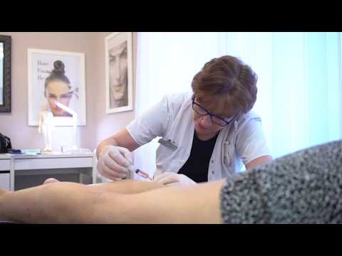 Thread Vein Treatment at www.beaconsfieldtherapy.com