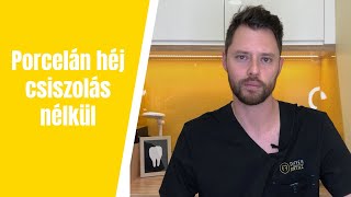 Porcelán héj csiszolás nélkül? Lumineer