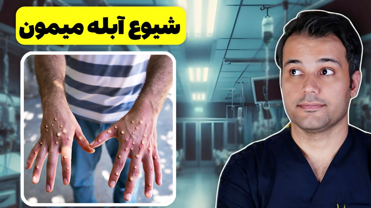 هشدار آبله میمون: چگونه علایم رو تشخیص بدیم و درمانش کنیم؟