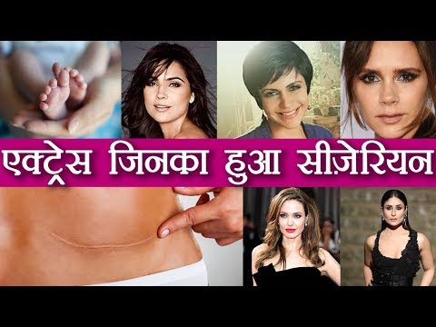 download lagu mp3 mp4 Kareena Delivery Normal Or C Section, download lagu Kareena Delivery Normal Or C Section gratis, unduh video klip Kareena Delivery Normal Or C Section