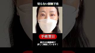 Download lagu 【切らない眼瞼下垂】手術翌日#眼瞼下垂#美容整形#shorts mp3