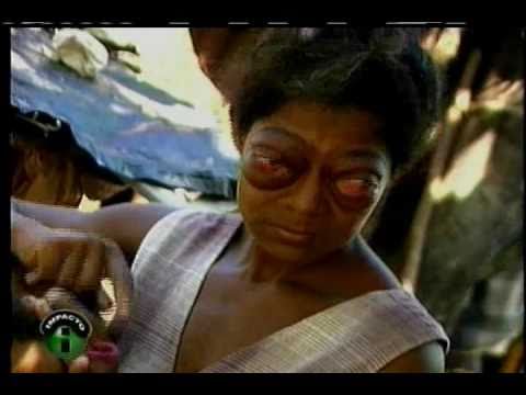 Impacto con Sergio Garcia - Minelva y sus ojos llenos de Esperanza.