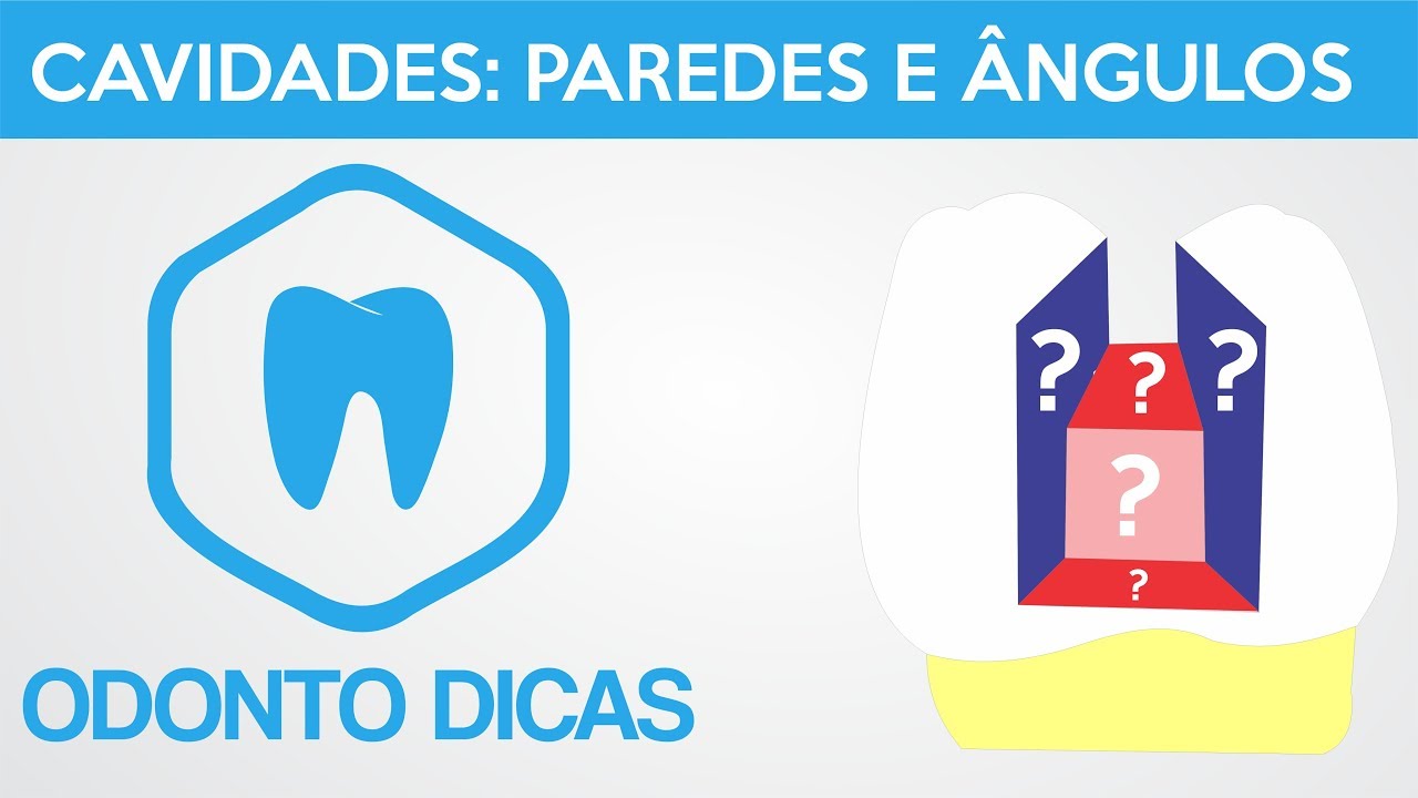 CAVIDADES: PAREDES E ÂNGULOS | ODONTO DICAS