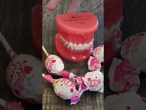 Best Valentines 🌹❤️💋 Candy for Braces