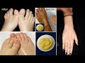 सालों साल जमी मैल व गंदगी शरीर से मिनट�
