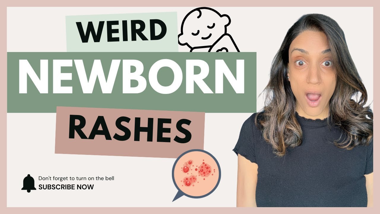 Newborn Rashes Explained: Common Baby Skin Conditions Parents Should Know
