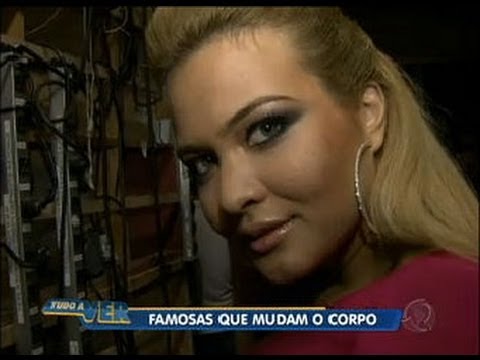 Tudo a Ver 01/08/2011: Famosas fazem plásticas para melhorar a forma física