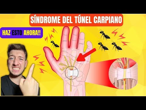 Exercises to relieve the pain of carpal tunnel syndrome