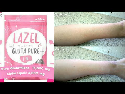 Lazel Glutapure Glutathione Skin Lightening Review / Iodine Test