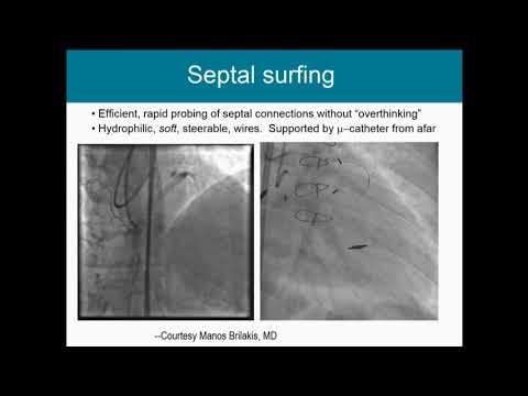 Retrograde: Step-by-Step - Farouc Jaffer, MD, PhD