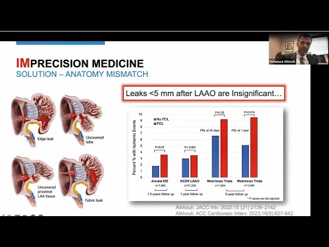 "Wired for Precision: How AI is Rewriting the Cath Lab Blueprint”