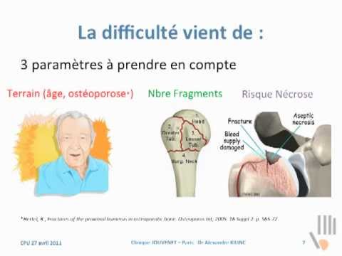 comment soigner fracture trochiter