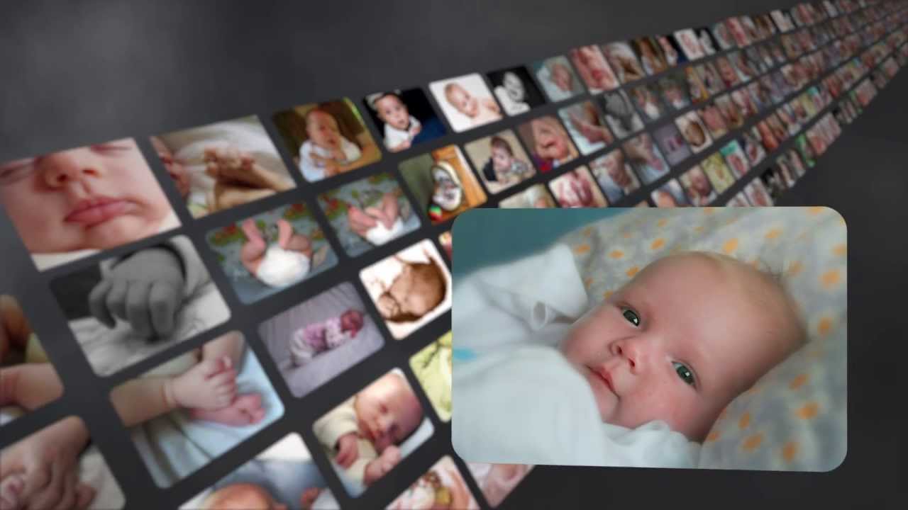 International Cri du Chat Awareness Video thumbnail