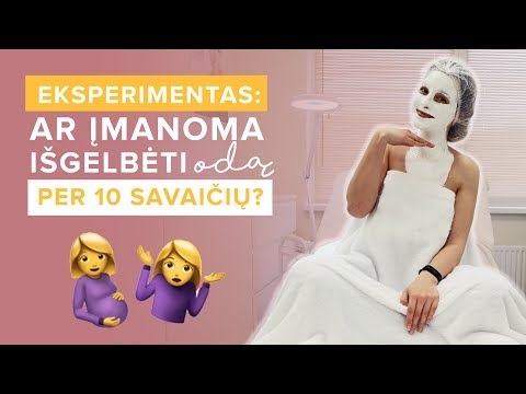 negaliu numesti svorio būdamas 26 metų natūralūs riebalų deginimo junginiai