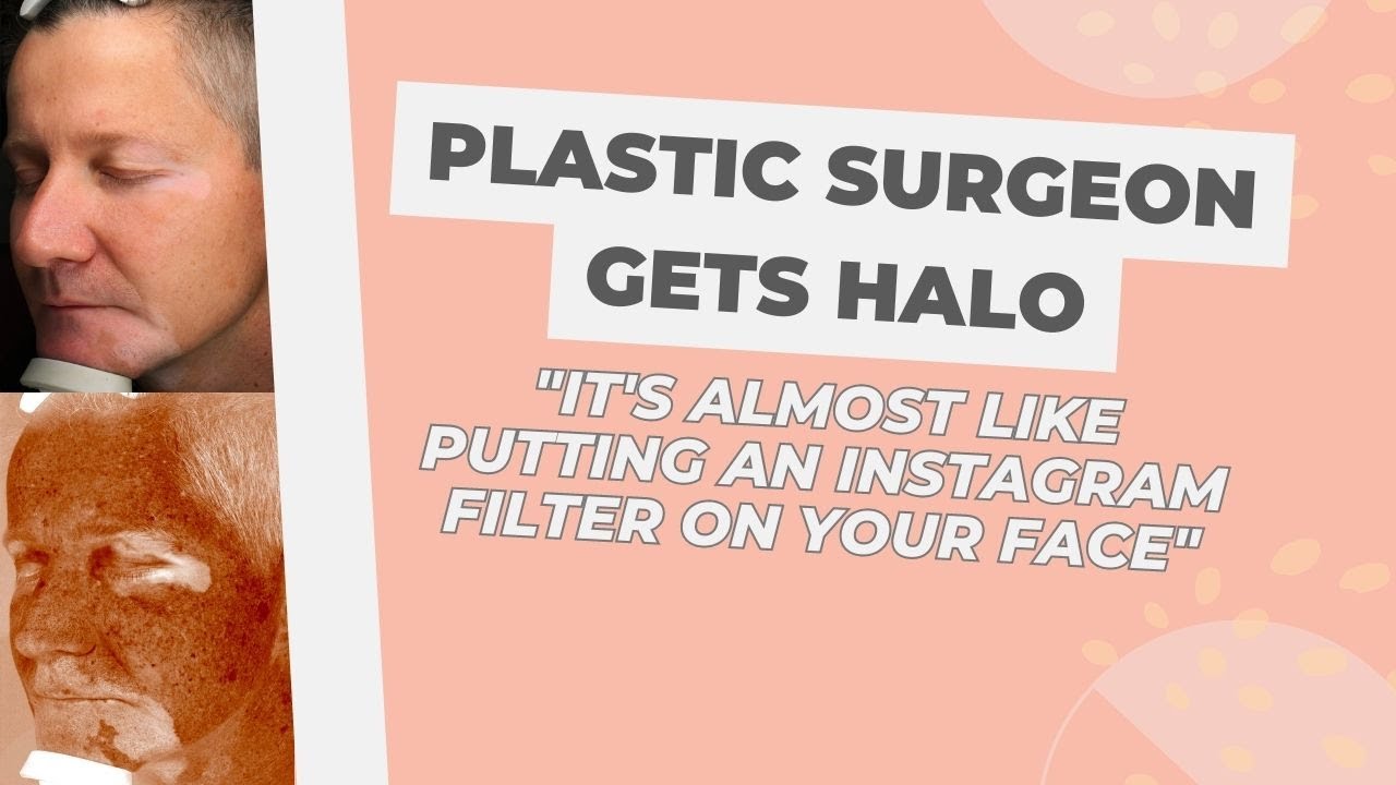 I’m a Plastic Surgeon, I had Halo Laser Treatment and Here’s What Happened (Part 3 of 3)