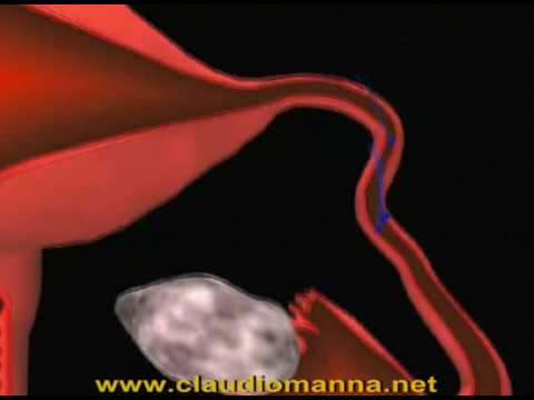 Medicina per le articolazioni gialurom Mal di collo e la testa che trattano
