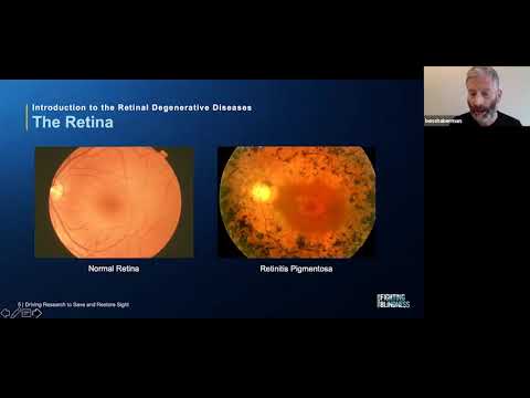 An Eye on Education: Introduction to the Retinal Degenerative Diseases
