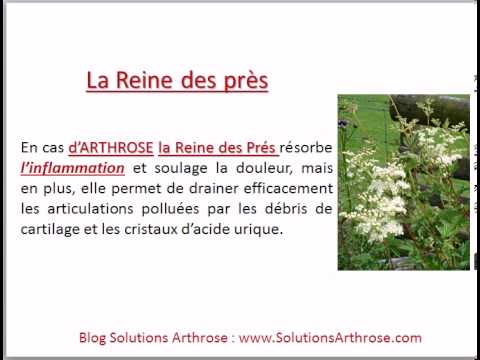 comment soulager l'arthrose par homeopathie