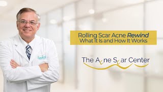 Most Effective Rolling Acne Scar Treatment - Rolling Scar Rewind